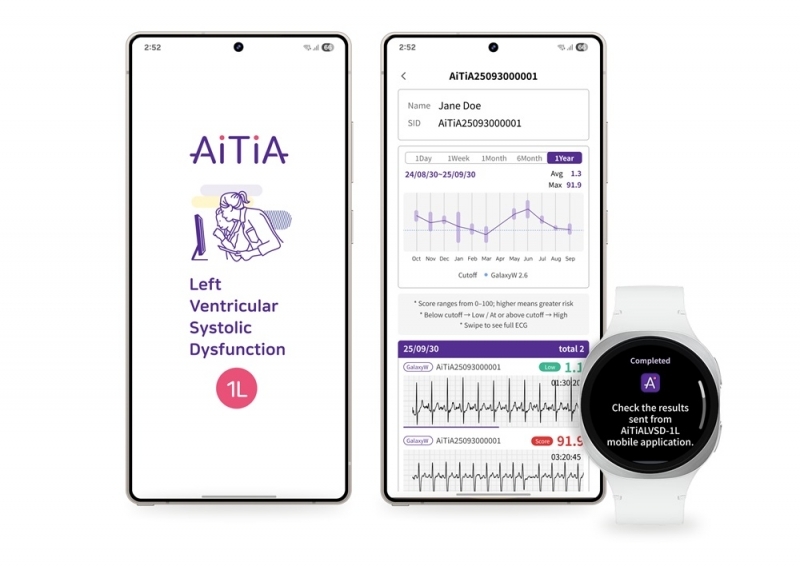 TecnologÃa de Samsung detectará causas de insuficiencia cardÃaca TecnologÃa de Samsung detectará causas de insuficiencia cardÃaca